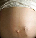 Достоверные признаки беременности